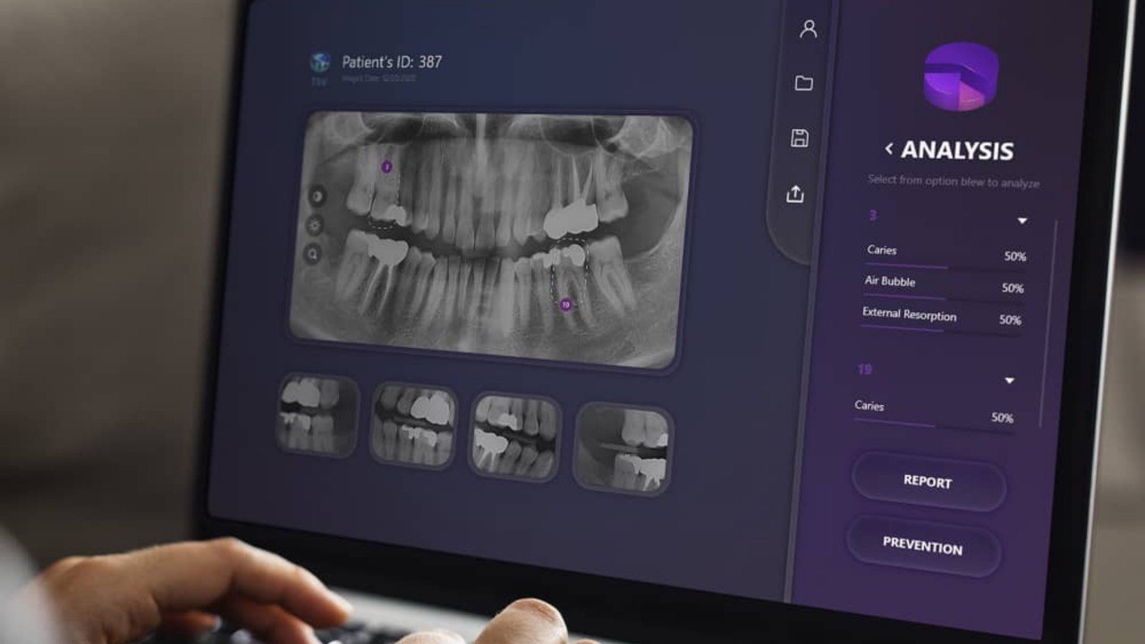 Early TSV interface concept showing a panoramic dental radiograph and analysis panel