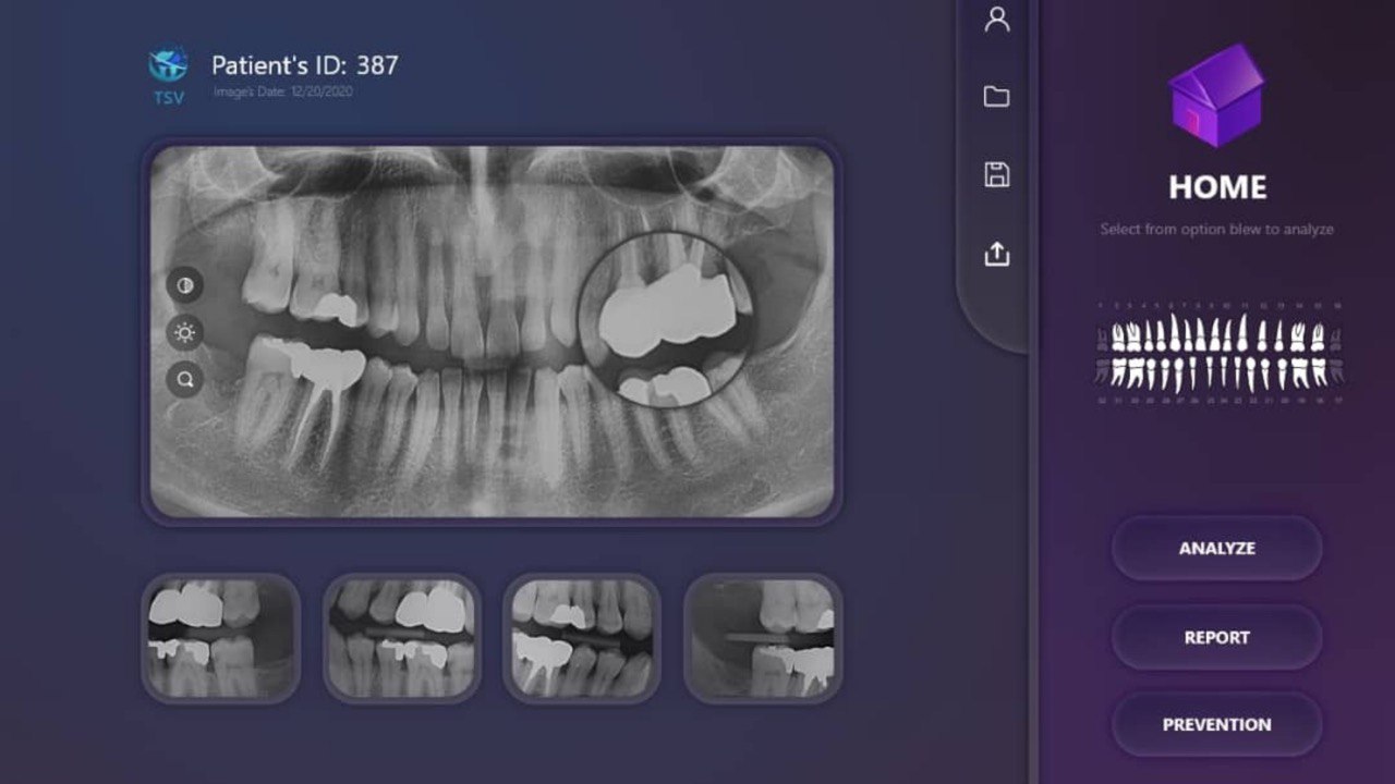 Early TSV interface concept showing a panoramic radiograph and navigation controls